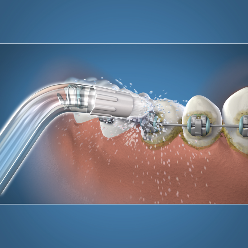 Ponta Ortodôntica Waterpik WOD-2E