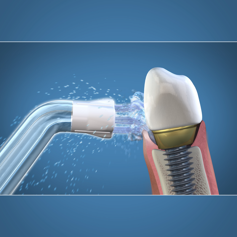Ponta Plaque Seeker Branqueador Waterpik WPS-2E
