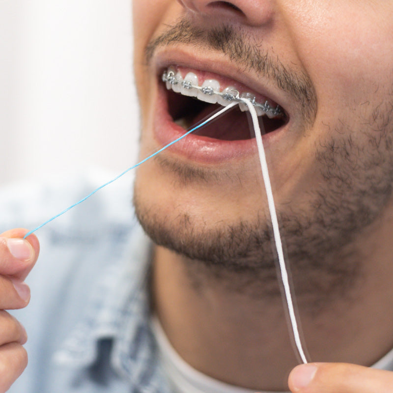 Fio Dental Jordan Clinic para Aparelhos